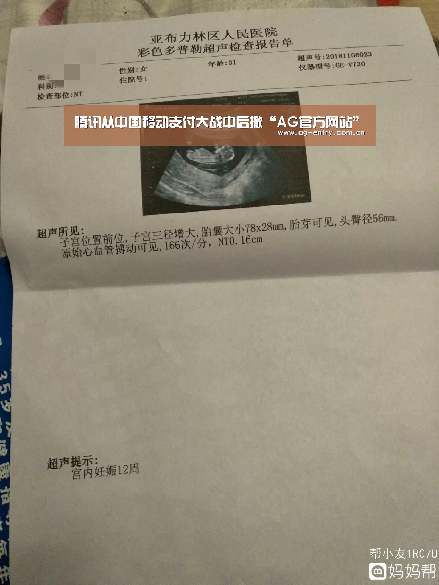 AG真人娱乐